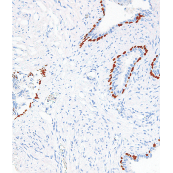 genomeme_antibodies.png